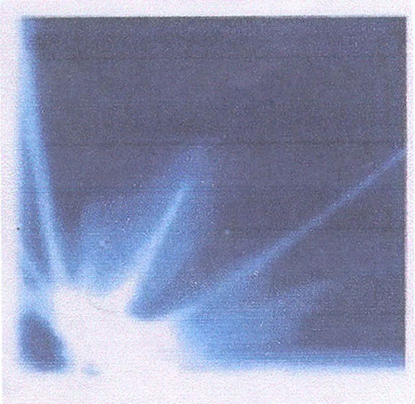 Acta 1001142