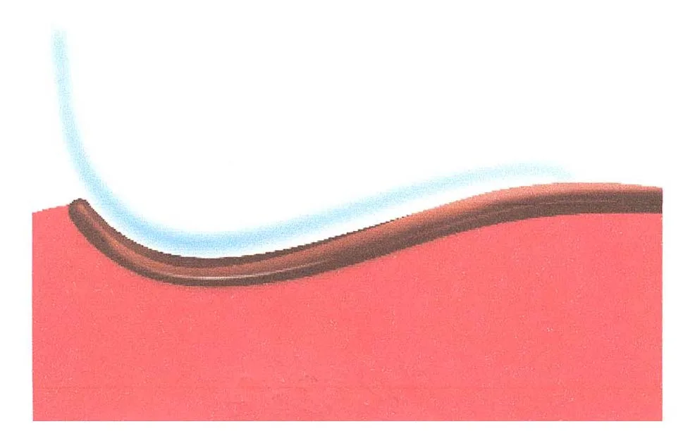 Acta 923237