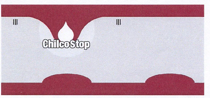 CHILCO STOP
