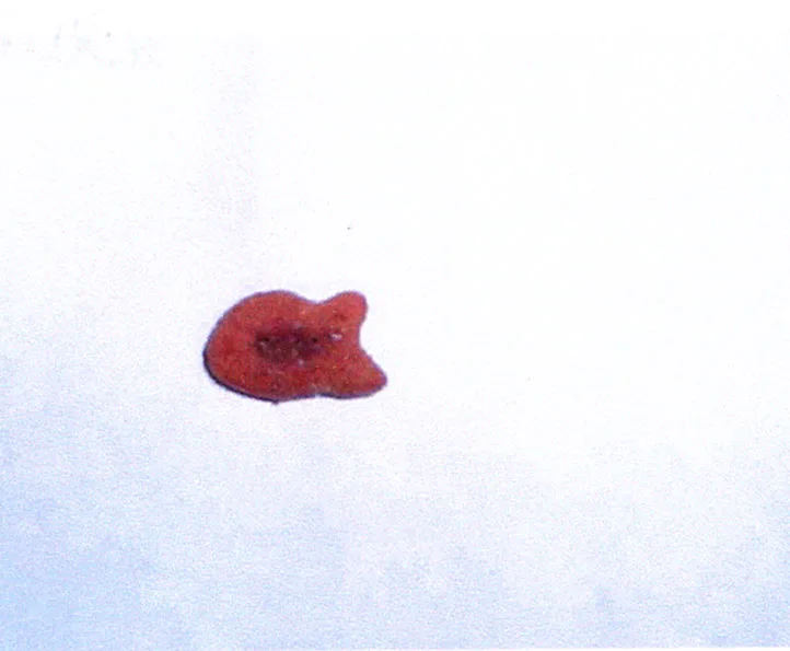 Acta 1113470