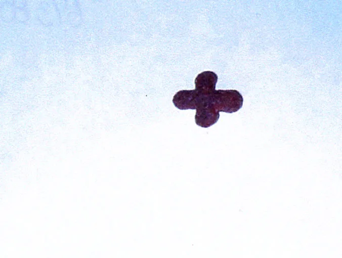 Acta 1113471
