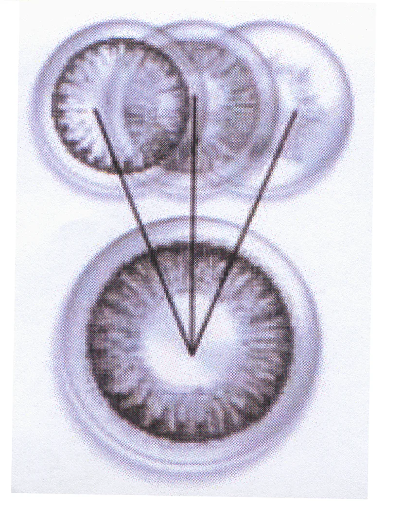 Acta 1006505